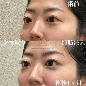 30 days after image