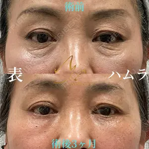 120 days after image