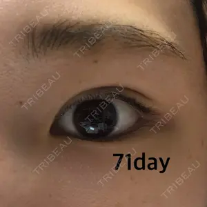 71 days after image