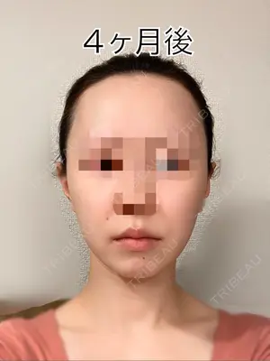 120 days after image