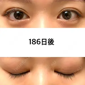 186 days after image