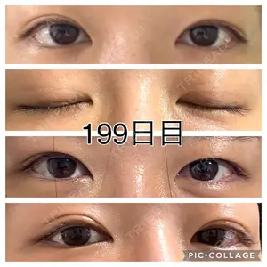 199 days after image