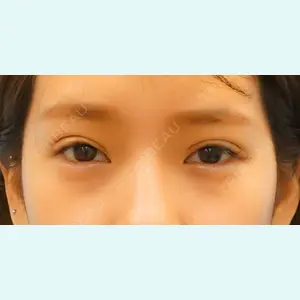 麹町皮ふ科・形成外科クリニックの症例