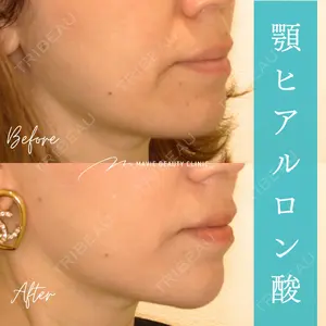 Mavie Beauty Clinic （マヴィービューティークリニック） 渡邉 憲一郎医師の症例