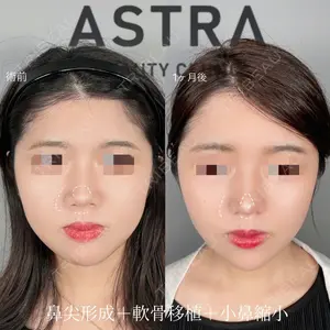 ASTRA BEAUTY CLINIC 塩満 惠子医師の症例