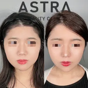 ASTRA BEAUTY CLINIC 塩満 惠子医師の症例