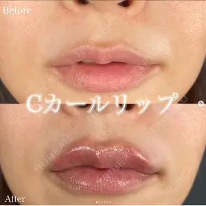 ルラ美容クリニック 上野院の症例