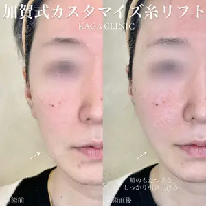 KAGA CLINIC 加賀 裕基医師の症例