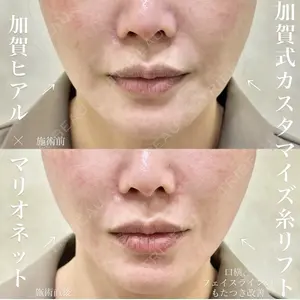 KAGA CLINIC 加賀 裕基医師の症例