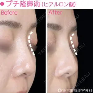 東京形成美容外科 船橋院 山崎 修吾医師の症例