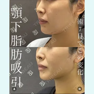 EMMO FACE CLINIC 大宮院 廣松 直樹医師の症例