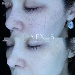 NEXUS CLINIC 酒井　知子医師の症例