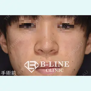 B-LINE CLINIC 池袋院 小池 康弘医師の症例