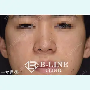 B-LINE CLINIC 池袋院 小池 康弘医師の症例