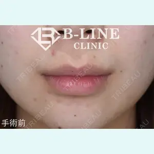 B-LINE CLINIC 池袋院 小池 康弘医師の症例