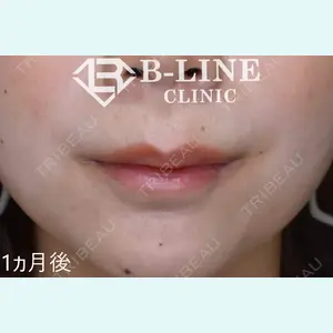 B-LINE CLINIC 池袋院 小池 康弘医師の症例