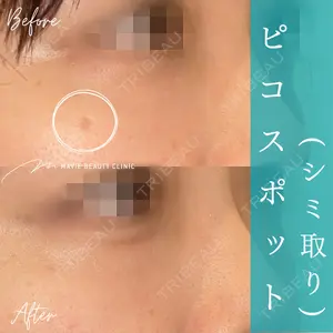 Mavie Beauty Clinic （マヴィービューティークリニック）の症例