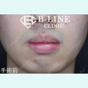 B-LINE CLINIC 池袋院 小池 康弘医師の症例