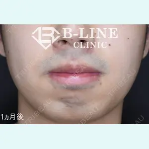 B-LINE CLINIC 池袋院 小池 康弘医師の症例