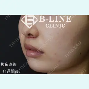 B-LINE CLINIC 池袋院 小池 康弘医師の症例