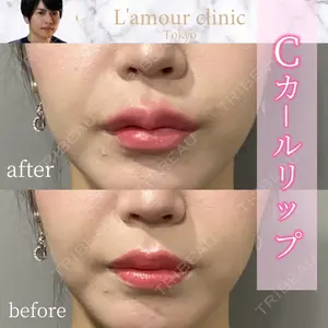 L‘amour clinic Tokyo【ラムールクリニック東京】 片岡 紘士医師の症例