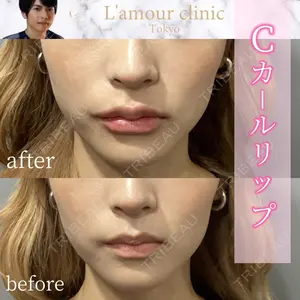 L‘amour clinic Tokyo【ラムールクリニック東京】 片岡 紘士医師の症例