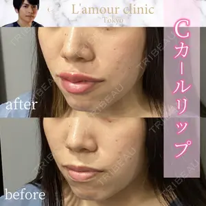 L‘amour clinic Tokyo【ラムールクリニック東京】 片岡 紘士医師の症例