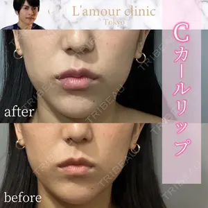 L‘amour clinic Tokyo【ラムールクリニック東京】 片岡 紘士医師の症例