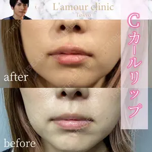 L‘amour clinic Tokyo【ラムールクリニック東京】 片岡 紘士医師の症例