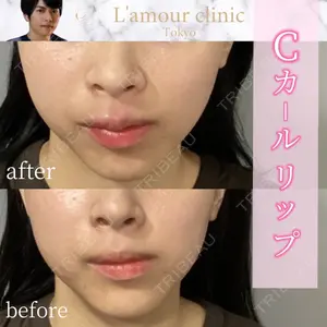 L‘amour clinic Tokyo【ラムールクリニック東京】 片岡 紘士医師の症例