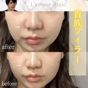 L‘amour clinic Tokyo【ラムールクリニック東京】 片岡 紘士医師の症例