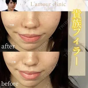 L‘amour clinic Tokyo【ラムールクリニック東京】 片岡 紘士医師の症例