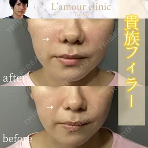 L‘amour clinic Tokyo【ラムールクリニック東京】 片岡 紘士医師の症例