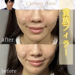 L‘amour clinic Tokyo【ラムールクリニック東京】 片岡 紘士医師の症例