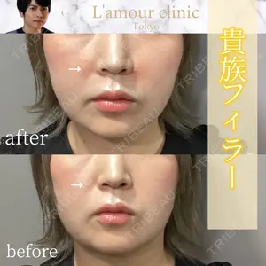 L‘amour clinic Tokyo【ラムールクリニック東京】 片岡 紘士医師の症例