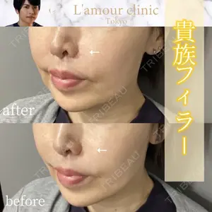 L‘amour clinic Tokyo【ラムールクリニック東京】 片岡 紘士医師の症例