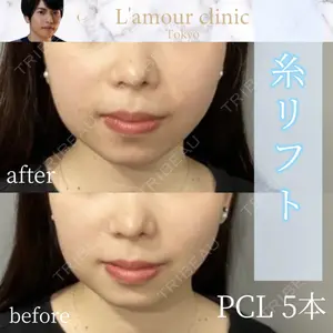 L‘amour clinic Tokyo【ラムールクリニック東京】 片岡 紘士医師の症例