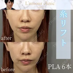 L‘amour clinic Tokyo【ラムールクリニック東京】 片岡 紘士医師の症例