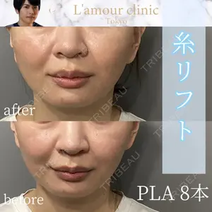 L‘amour clinic Tokyo【ラムールクリニック東京】 片岡 紘士医師の症例