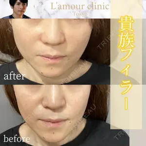 L‘amour clinic Tokyo【ラムールクリニック東京】の症例