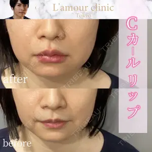 L‘amour clinic Tokyo【ラムールクリニック東京】の症例