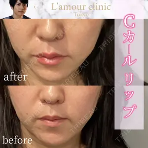 L‘amour clinic Tokyo【ラムールクリニック東京】の症例