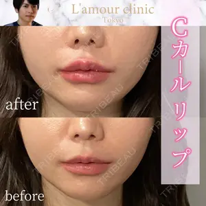 L‘amour clinic Tokyo【ラムールクリニック東京】の症例