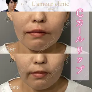 L‘amour clinic Tokyo【ラムールクリニック東京】の症例