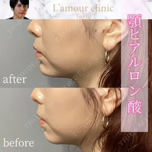 L‘amour clinic Tokyo【ラムールクリニック東京】の症例