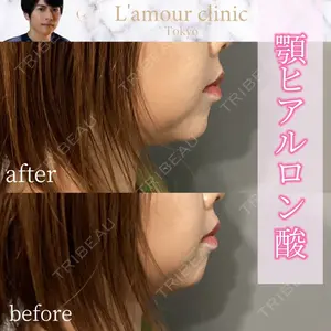 L‘amour clinic Tokyo【ラムールクリニック東京】の症例