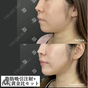 EMMO FACE CLINIC 大阪梅田院 山﨑 冴羅医師の症例