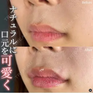 ルラ美容クリニック 千葉院 / ルラスキンクリニック 千葉院 下川 洋輝医師の症例