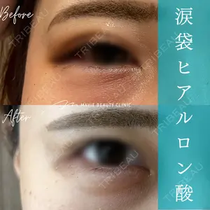 Mavie Beauty Clinic （マヴィービューティークリニック） 渡邉 憲一郎医師の症例