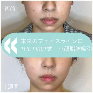 THE FIRST CLINIC 多摩センター院 惟村 公郁医師の症例